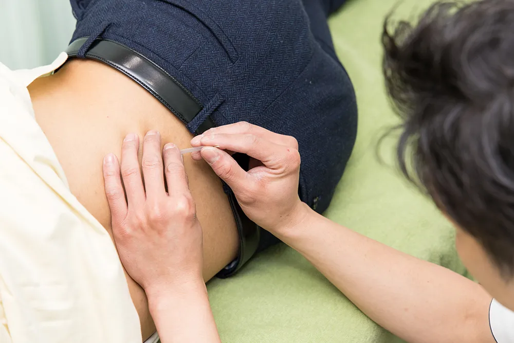 保険適用で受けられる鍼灸による施術について